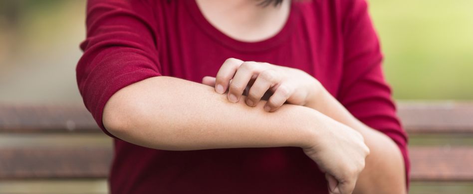 Schuppenflechte: Behandlung von Psoriasis