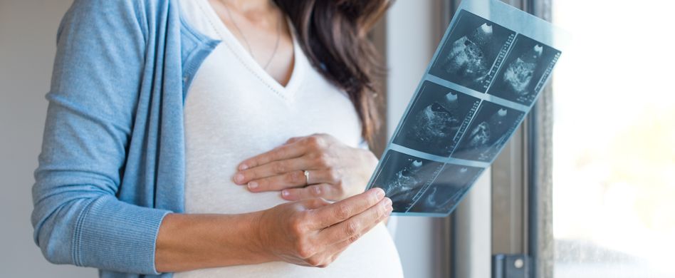 Schwanger in der Probezeit