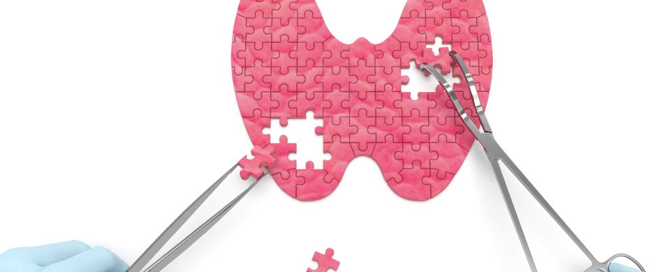 Selbsttest Schilddrüse: Ist meine Schilddrüse gesund?