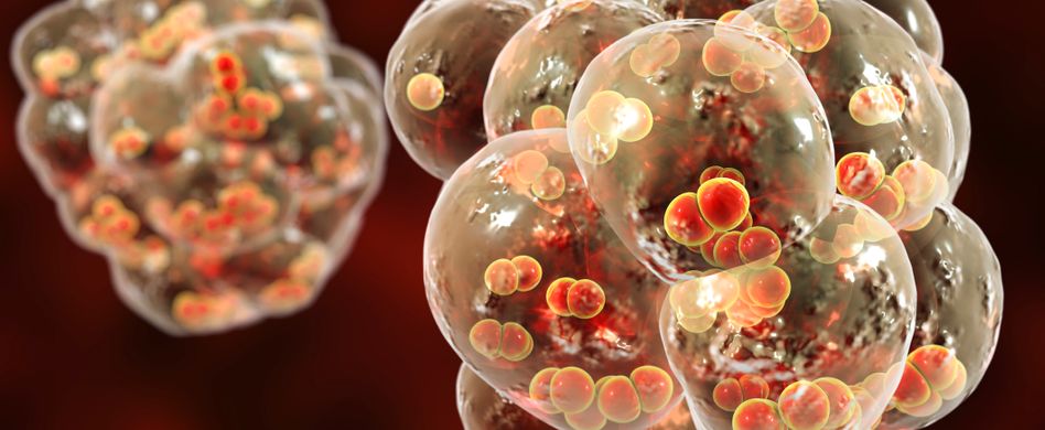 Streptokokken, Pneumokokken und Co.: Das sind die Ursachen einer Tonsillitis