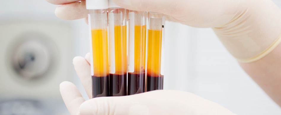 Thrombozyten: Aufgaben und Referenzwerte der Blutplättchen