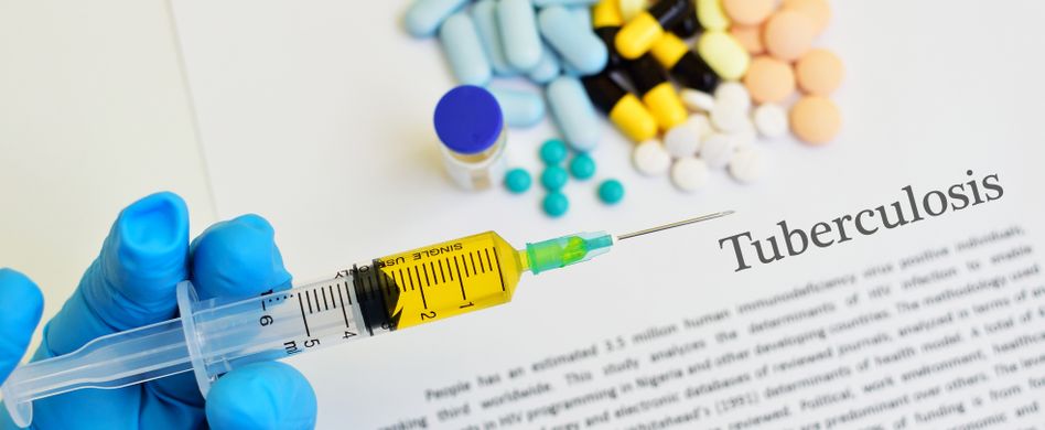 Tuberkulose: Symptome, Behandlung & Tuberkulose-Impfung