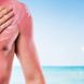 Verbrannte Haut: Wie lange dauert Sonnenbrand?