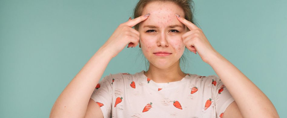 Vitamin A für schöne Haut: Von Cremes und Säure-Peelings