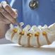 Vitamin-D-Mangel: Ursachen, Symptome, Folgen