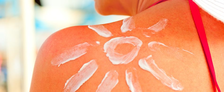 Warum ist Sonnenbrand schädlich für die Haut?