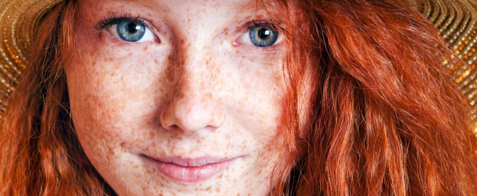 Warum Menschen Sommersprossen bekommen