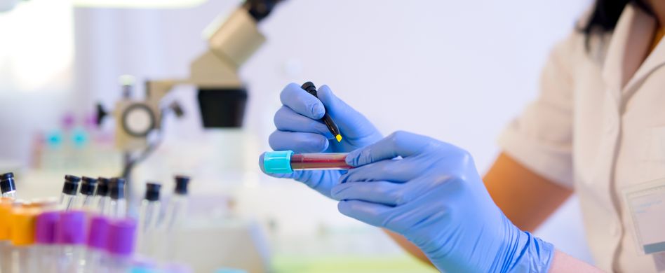 Was beinhaltet das große Blutbild? Diese Werte bestimmt der Arzt