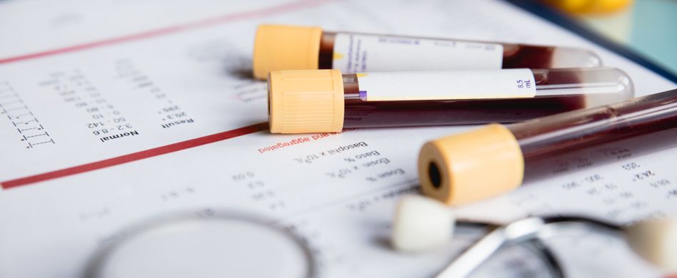 Was beinhaltet das kleine Blutbild? Diese Werte bestimmt der Arzt