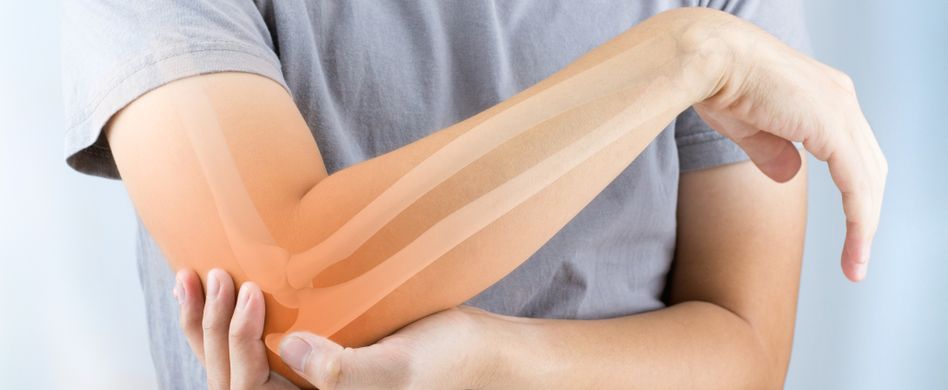 Was ist eigentlich Arthrose?