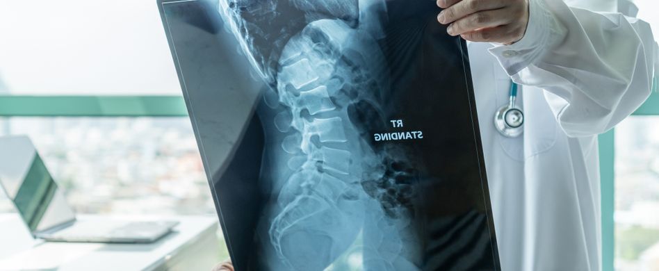 arzt hält rontgenbild von wirbelsäule