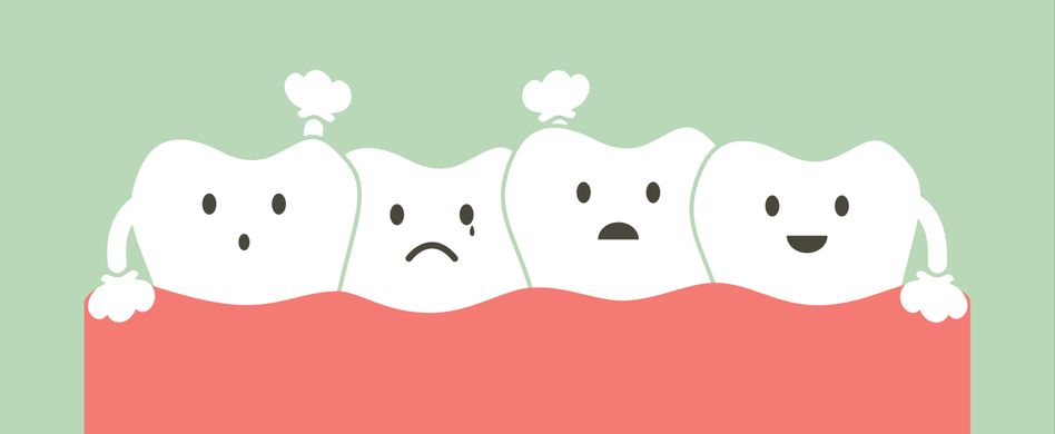 Welche Zahn- und Kieferfehlstellungen gibt es? Kreuzbiss, Überbiss & Co.