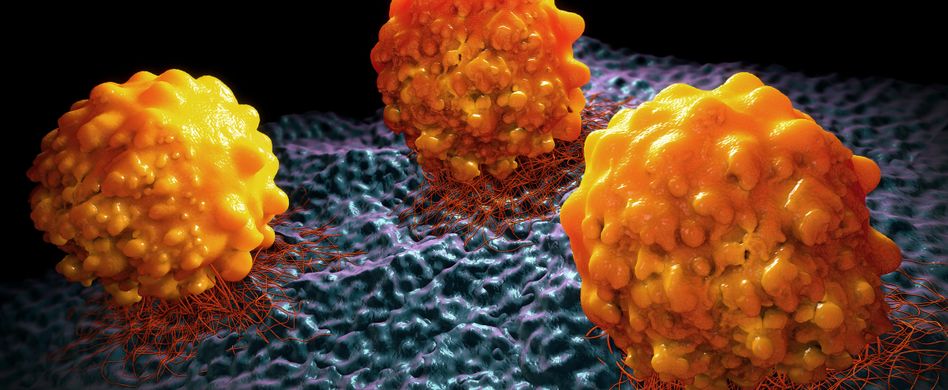 Welcher Krebs streut wohin?