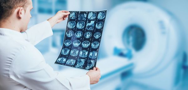 wernicke-enzephalopathie-symptome-und-verlauf-bild-1