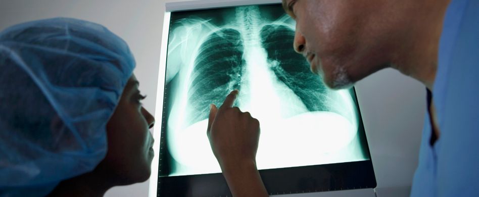 Wie lange dauert ein Rippenbruch? Behandlung der Verletzung