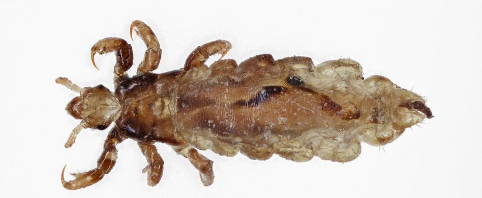 Wie sehen Läuse aus? So! Der Parasit im Bild