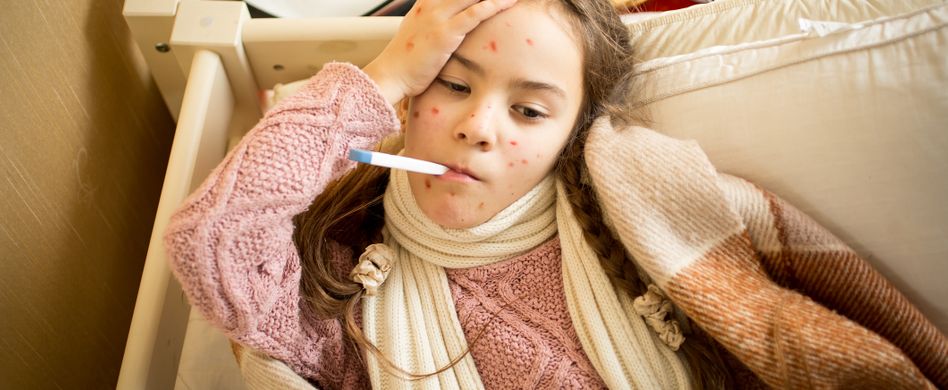 Windpocken-Symptome: Daran erkennen Sie, dass Ihr Kind Windpocken hat