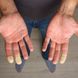 Raynaud-Syndrom: Ursachen, Symptome & Behandlung der Weißfingerkrankheit