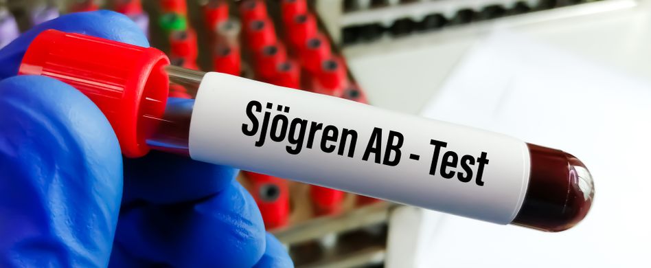 Sjögren-Syndrom: Ursachen, Symptome & Behandlung der Autoimmunerkrankung