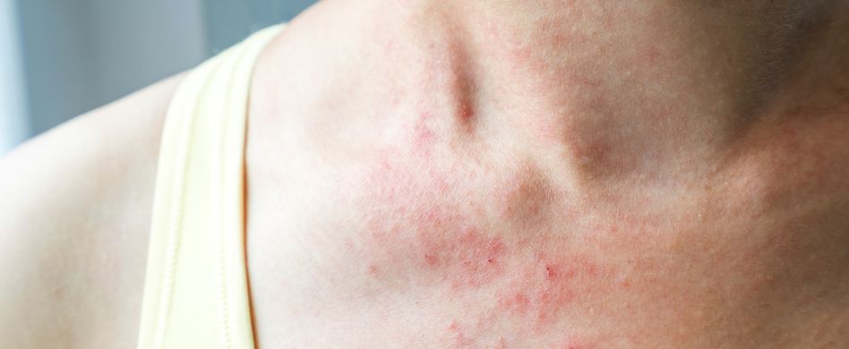 Achtung Hautpilz: 5 häufige Pilzerkrankungen des Körpers