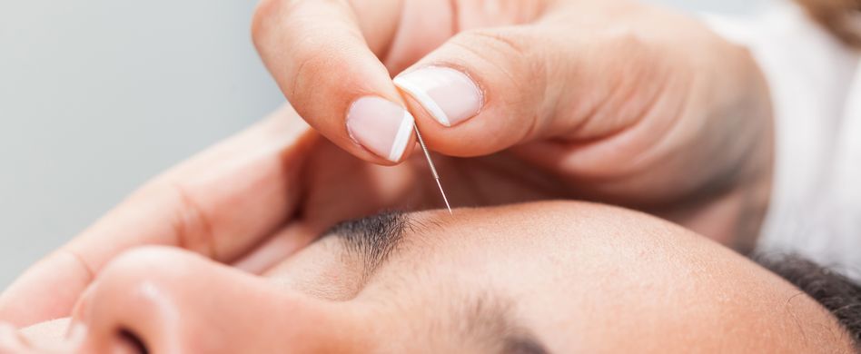 Akupunktur-Nebenwirkungen: Das kann bei der Akupunktur passieren