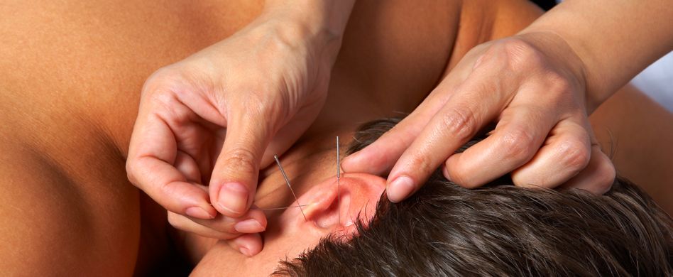 Akupunkturpunkte am Ohr: Was die Nadeln hier bewirken können