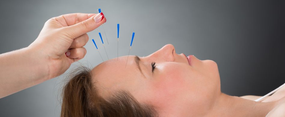 Die 4 wichtigsten Akupunkturpunkte am Kopf