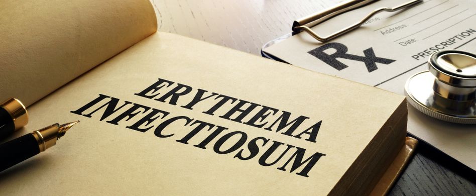 Erythema infectiosum: Was sind Ringelröteln?