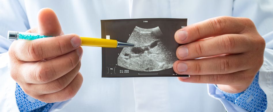 arzt zeigt ultraschallbild von galle