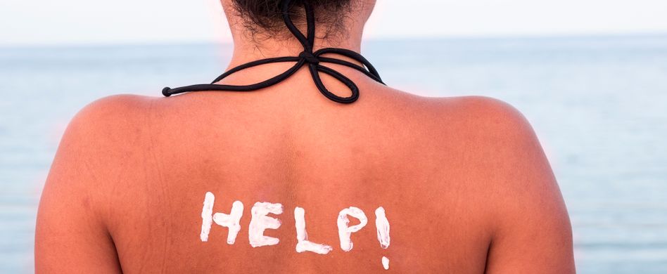 Haut pellt sich: 4 Pflegetipps nach dem Sonnenbrand