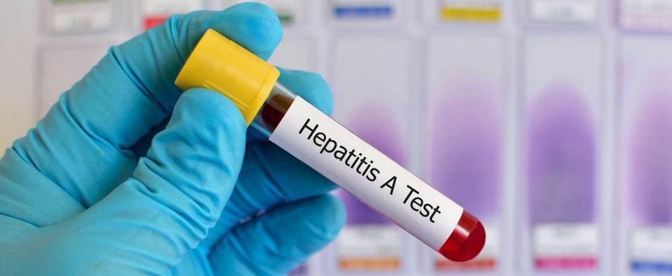 Hepatitis A: Symptome und Ansteckung