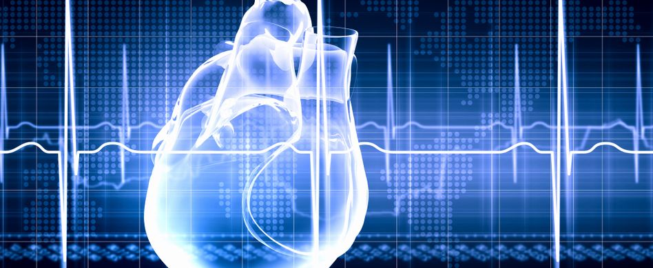 Herzinfarkt ohne Symptome: Stummer Herzinfarkt häufiger als gedacht
