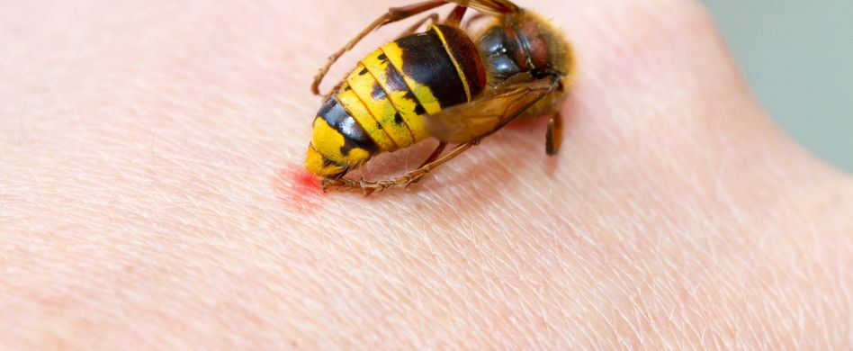 Insektenstiche behandeln: Was Sie tun können, wenn Biene, Bremse & Co. zustechen