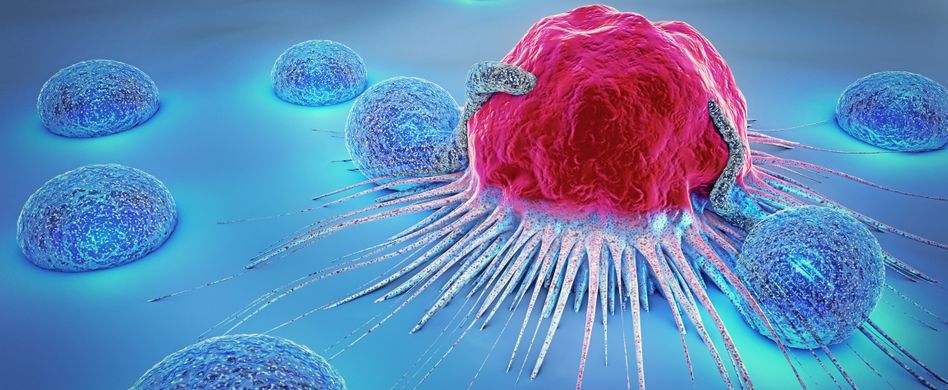 Krebs-Stadien: Welche Stufen durchläuft Krebs?
