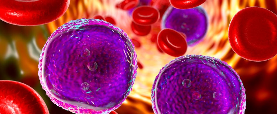 Leukämie bei Erwachsenen: 5 Fakten zu Blutkrebs
