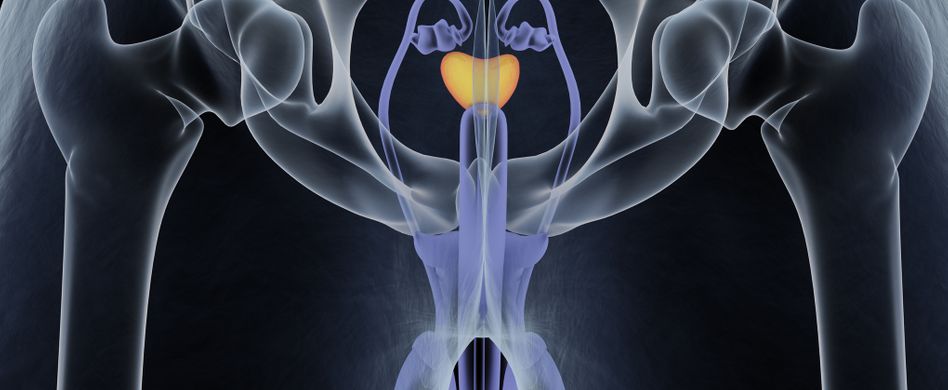 Prostatakrebs: 10 Fragen zum bösartigen Tumor der Vorsteherdrüse