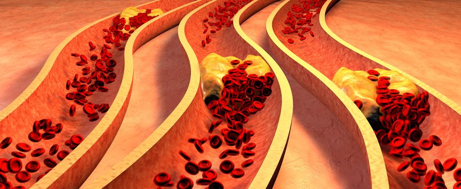 Was ist Cholesterin eigentlich?