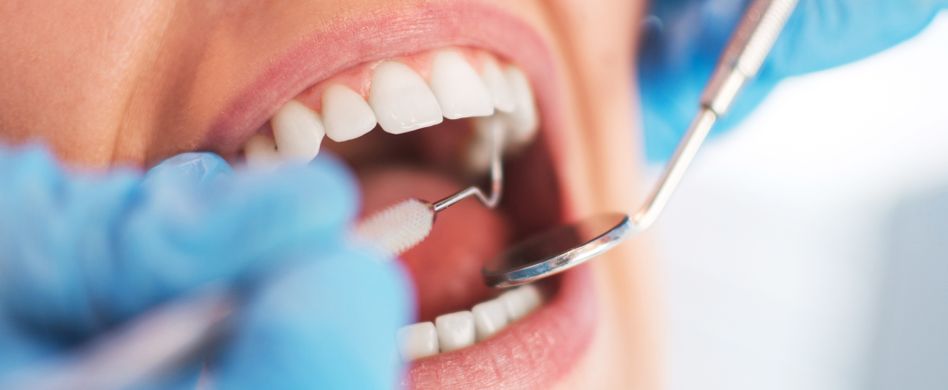 Zahnschmerzen: Ursachen für Zahnweh