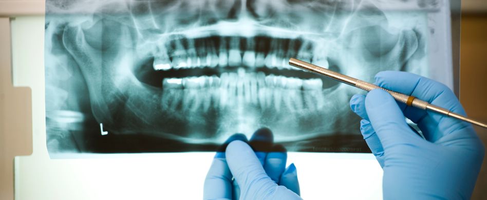 Zahnschmerzen: Wann stirbt der Zahnnerv ab?