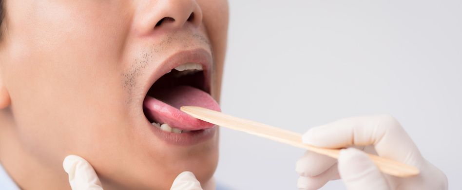 Zungenbrennen: Was hilft gegen die Schmerzen im Mund?